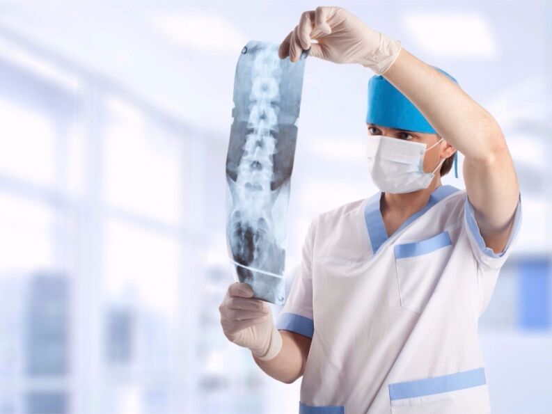 دکتر به یک عکس فوری از ستون فقرات گردنی با پوکی استخوان نگاه می کند