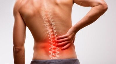 علائم و نشانه های پوکی استخوان ستون فقرات کمری